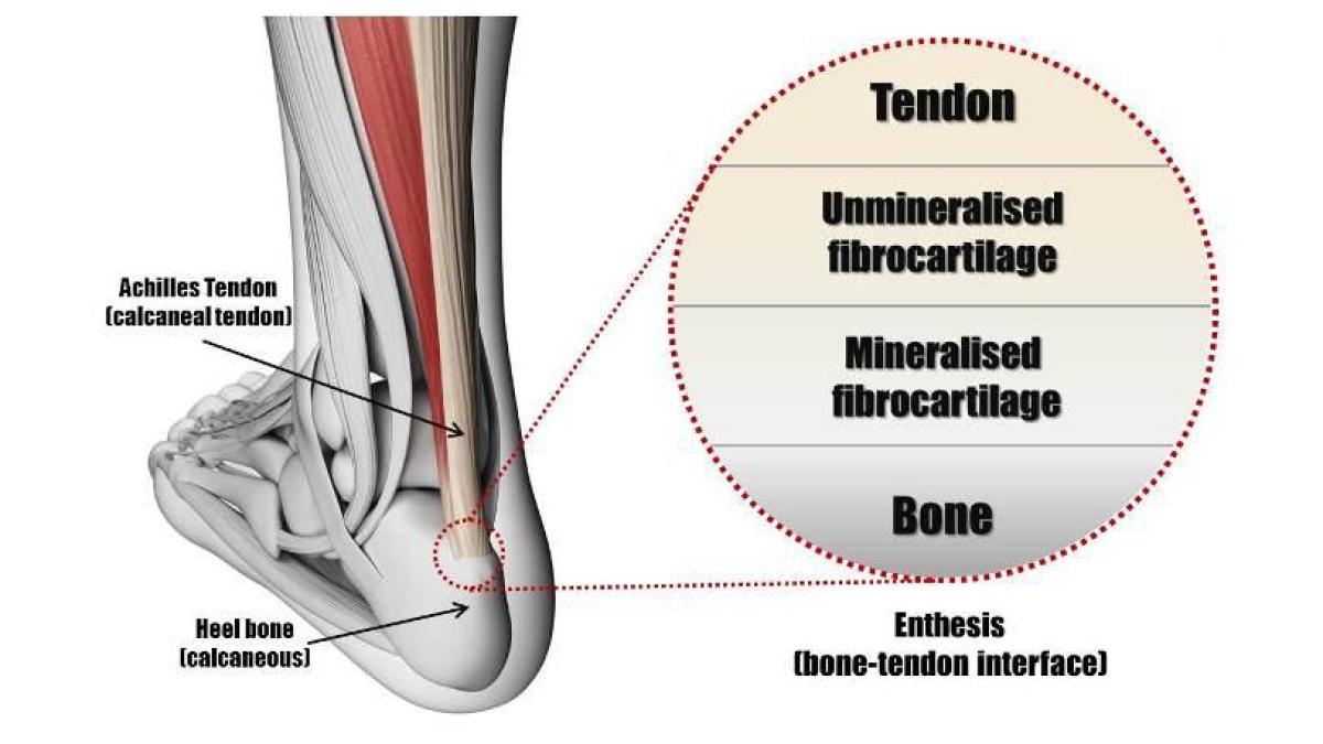 The bone-tendon interface and position of Achilles Tendon
