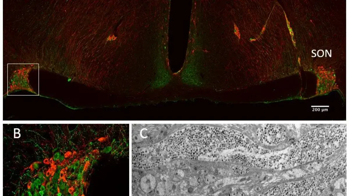 Coronal section through the rat hypothalamus at the level of the supraoptic (SON) and paraventricular nuclei (PVN)
