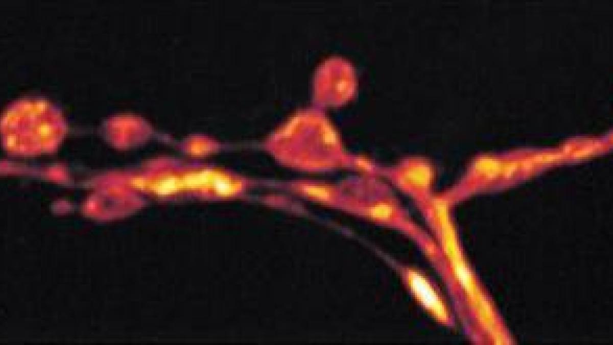 Synaptic terminals at the Drosophila larval neuromuscular junction visualized with an anti-HRP staining