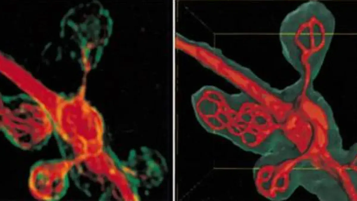 High resolution 3D deconvolution analysis (left) and 3D surface reconstruction (left) of microtubular network (red) inside boutons (green) at the Drosophila larval neuromuscular junction
