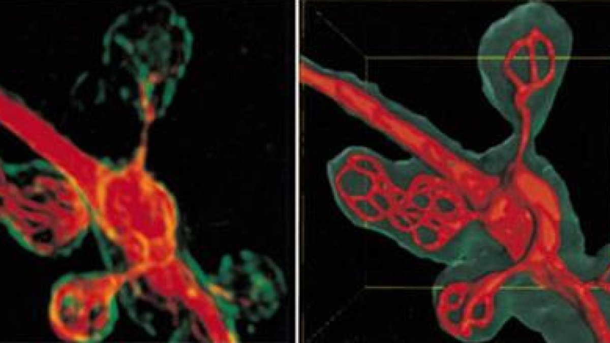 High resolution 3D deconvolution analysis (left) and 3D surface reconstruction (left) of microtubular network (red) inside boutons (green) at the Drosophila larval neuromuscular junction