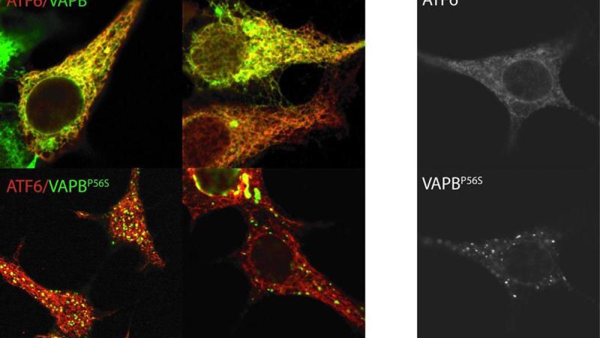 VAPB interacts with ATF6 and the ALS8 mutation causes VAPB to aggregate