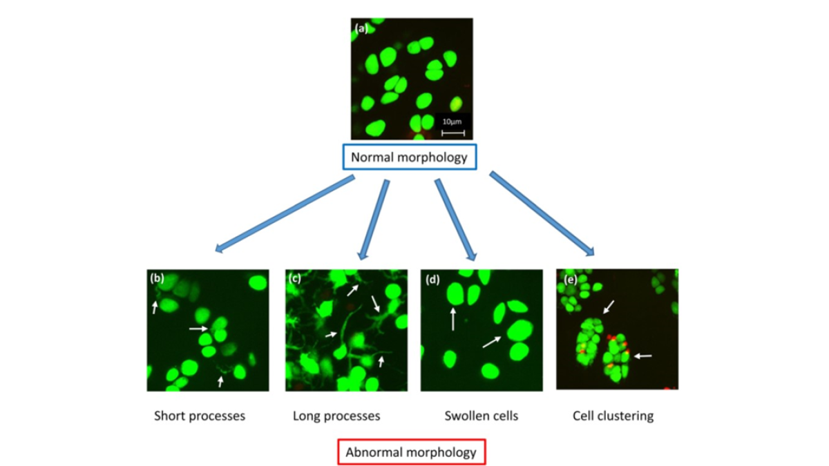 Figure 1. The variety of morphologies of in situ human chondrocytes within human cartilage. (a) shows the typical spheroidal/elliptical appearance of ‘normal’ chondrocytes and (b-e) example of a morphologically-abnormal chondrocytes with (b) short or (c) long cytoplasmic processes, (d) increased cell volume (hypertrophic) or cell clustering (e). Images taken from grade 0 (non-degenerate) and grade 1 (mildly degenerate) cartilage – see Hall 2019 for details). 