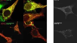 VAPB interacts with ATF6 and the ALS8 mutation causes VAPB to aggregate