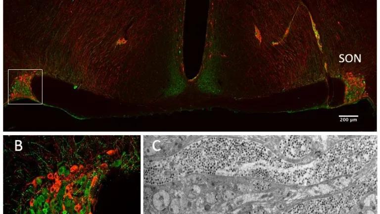 Coronal section through the rat hypothalamus at the level of the supraoptic (SON) and paraventricular nuclei (PVN)