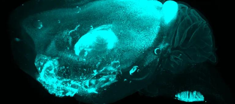 Optically cleared brain