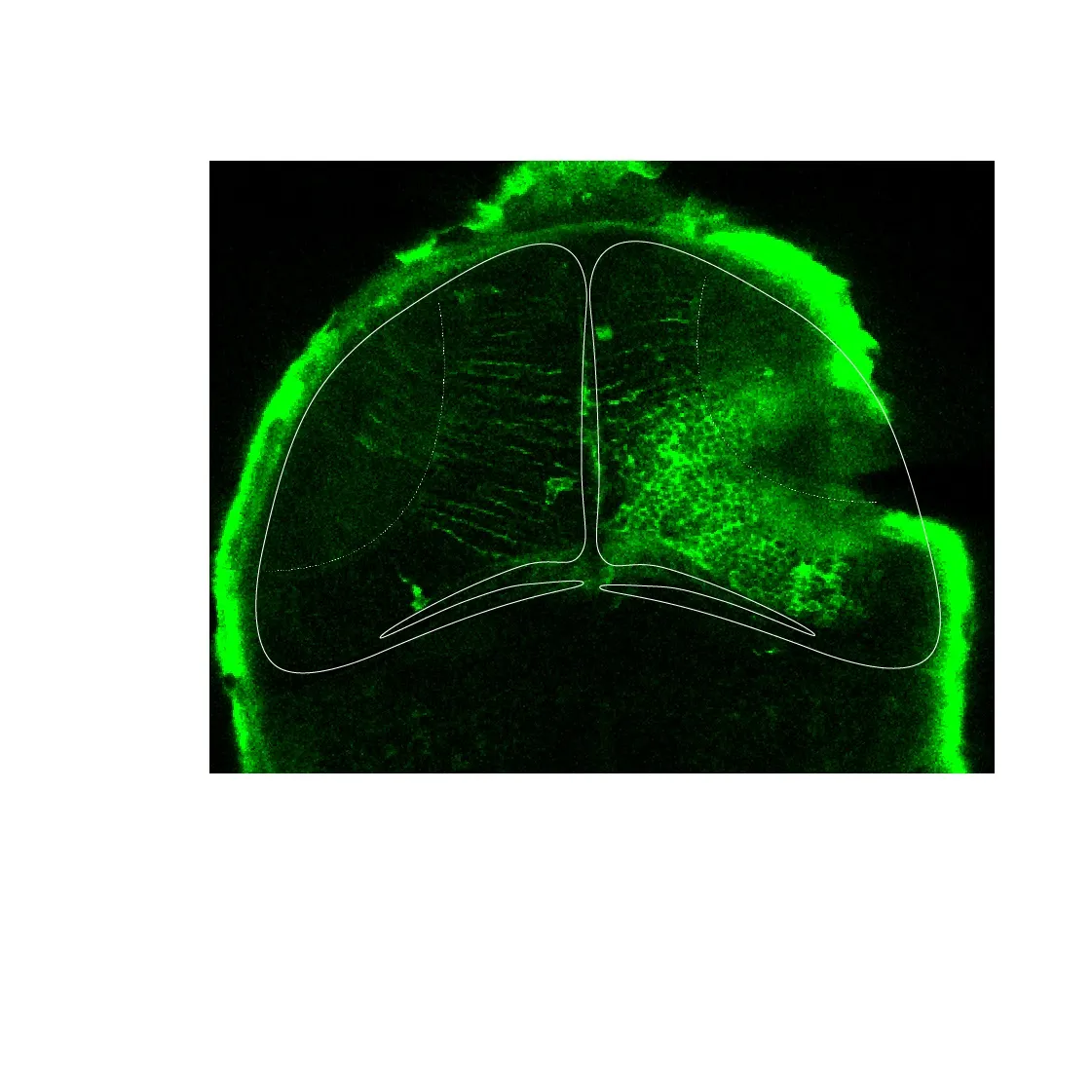 Calcium signalling in the brain of the larval zebrafish immediately after mechanical injury. This is visualised using the transgene β-actin:GCaMP6f.