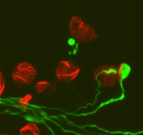 Representative confocal micrograph showing die-back pathology in an immunohistochemically-labelled external oblique muscle preparation from a late-symptomatic Smn2B/- mouse model