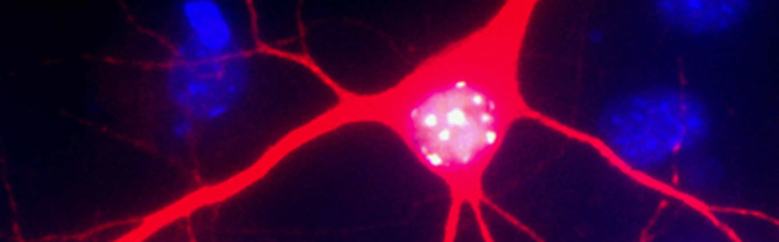 Expression of gene therapy vector derived MeCP2 in cortical neuron