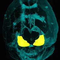 IC in the brain