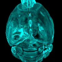 brain