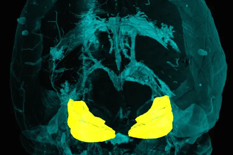 IC in the brain