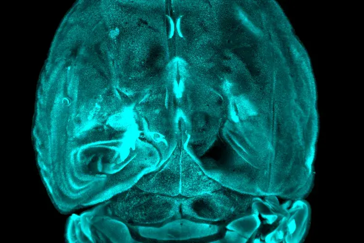 brain