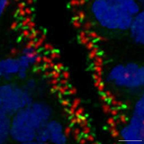 CDBS Thomas Theil Cilia 2 Cilia