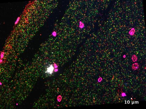 Monique Hooley - Figure 2 Figure 2. Hippocampal tissue from a mouse model of AD. Showing presynaptic protein synaptophysin (green) apposing postsynaptic P