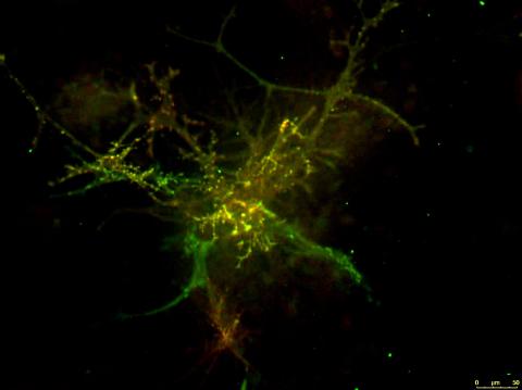 Figure 1. Primary mouse astrocyte DIV14. Glutamate transporters EAAT1 (green) and EAAT2 (red). 