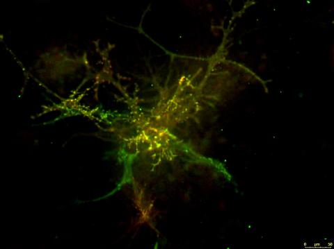 Monique Hooley - Figure 1 Figure 1. Primary mouse astrocyte DIV14. Glutamate transporters EAAT1 (green) and EAAT2 (red).