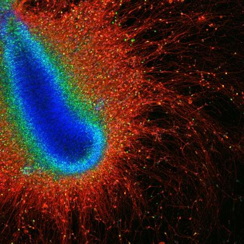 Image 2 Human neurons developing in vitro