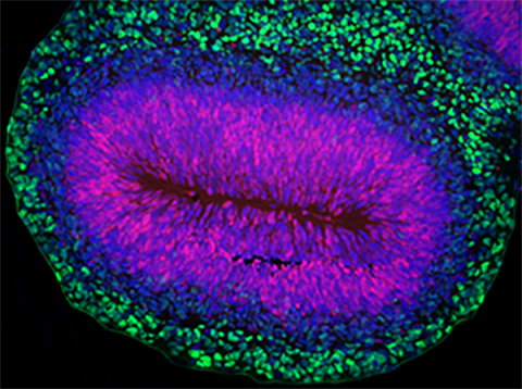 Prof John Mason Human Organoid 1