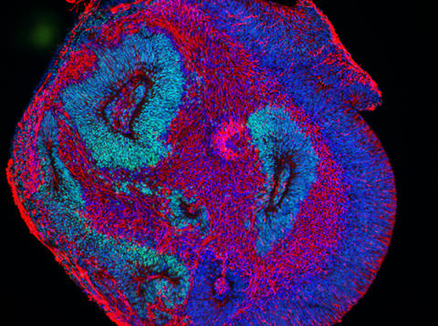 Prof John Mason Human Organoid 2
