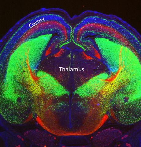 Mouse embryonic brain showing the thalamortical tract in red Mouse embryonic brain showing the thalamortical tract in red