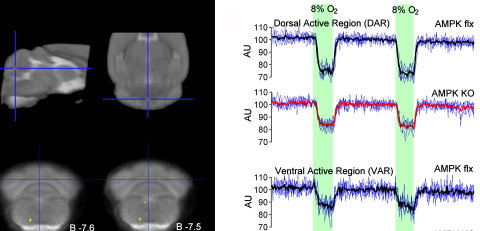 Website Fig 3 AMPK fMRI