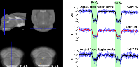 Website Fig 3 AMPK fMRI Website Fig 3 AMPK fMRI