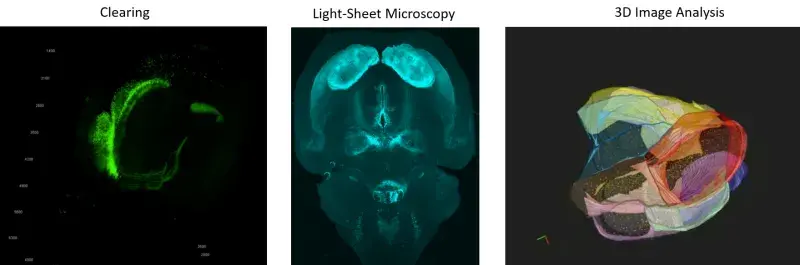 Clearing, Light-Sheet Microscopy, 3D Image Analysis