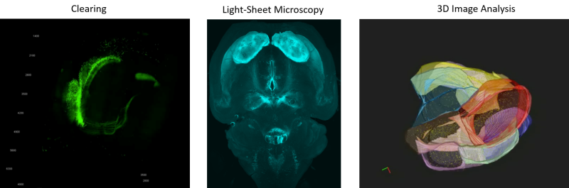 Clearing, Light-Sheet Microscopy, 3D Image Analysis