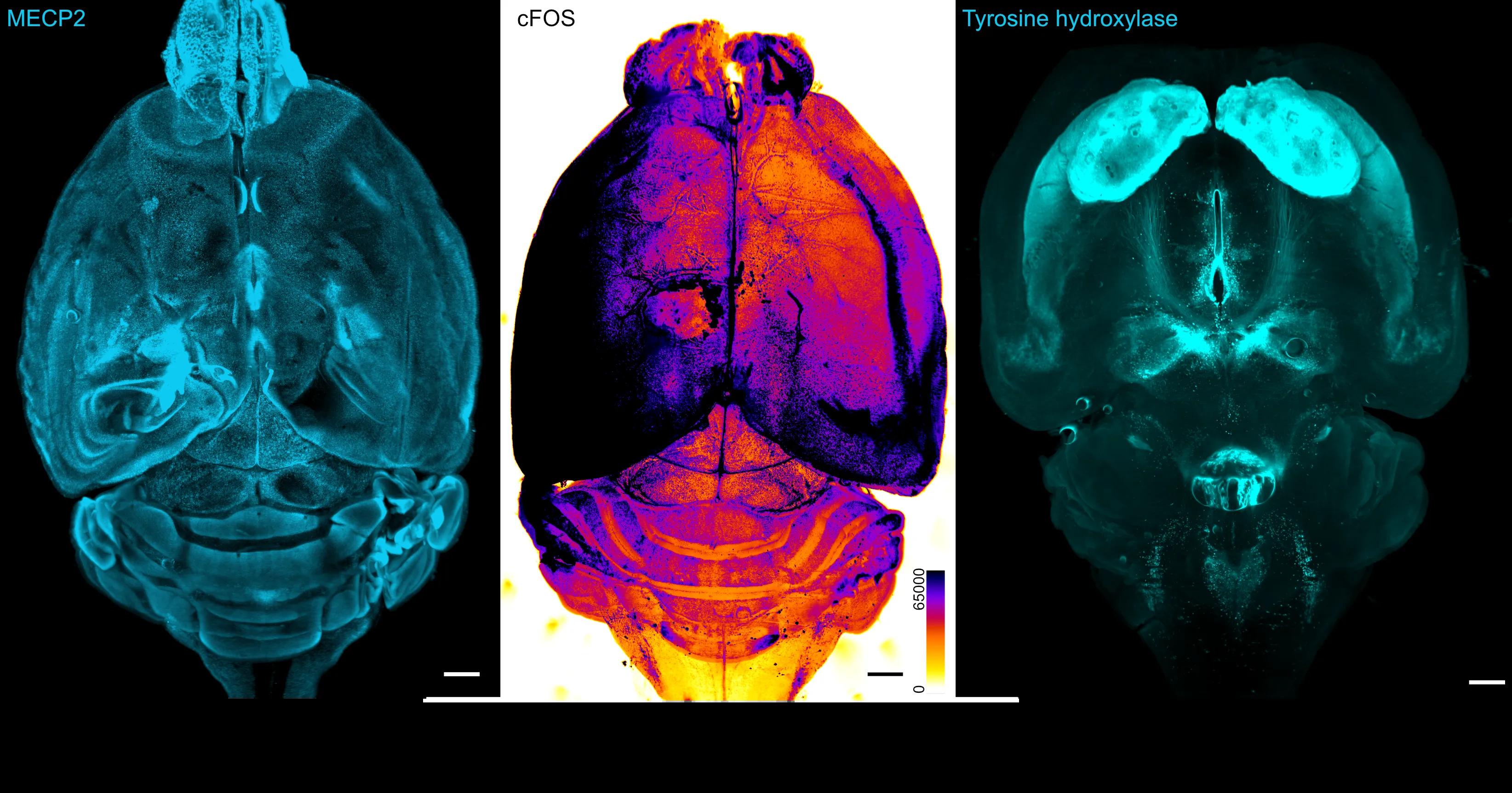 Light-sheet images of intact mouse brains