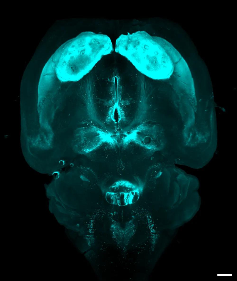 Brain image with TH labelling