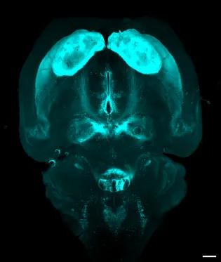 Brain image with TH labelling