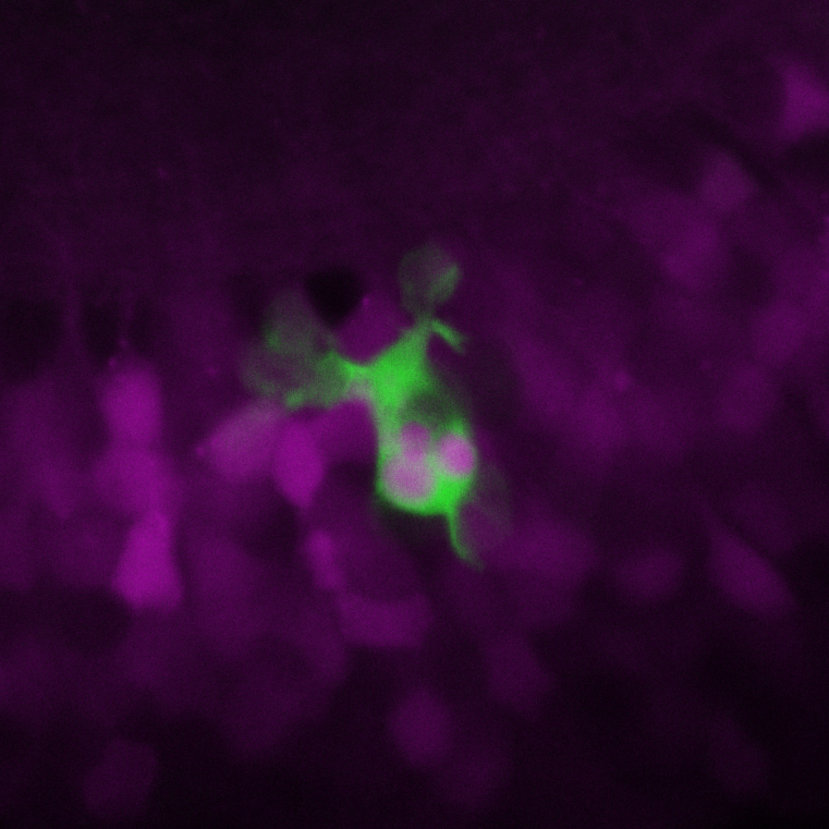A microglial cell (green) in between neurons (magenta) in the brain of the larval zebrafish after an injury. The microglial cell has phagocytosed three neurons (inside the microglial cell).