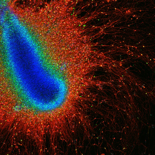 Human neurons developing in vitro